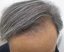 開始後2.5カ月後