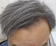 開始後8.5カ月後