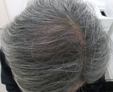 開始後2.5カ月後